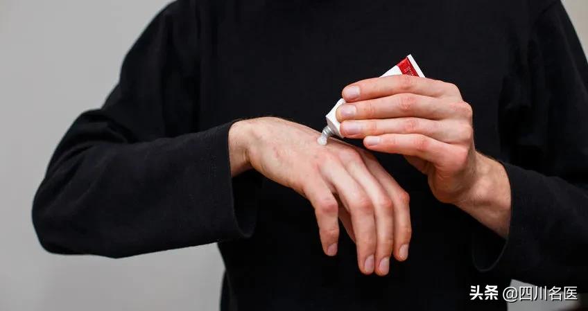 夏天手指长水疱疹怎么办,手上出现大面积的水泡很痒怎么办