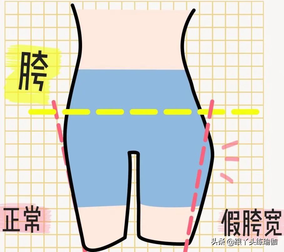 假胯宽盆骨矫正动作解析,矫正骨盆假胯宽的方法