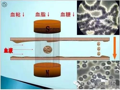 高血压血液粘稠应该怎样调理,血液粘稠怎么调理喝什么茶