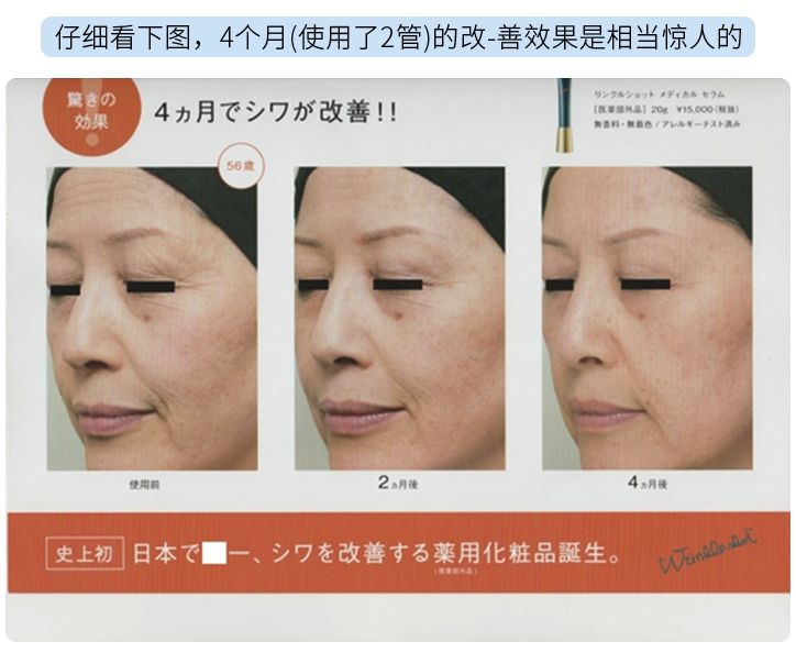 pola三合一精华,pola祛皱眼霜和cp黑眼球眼霜