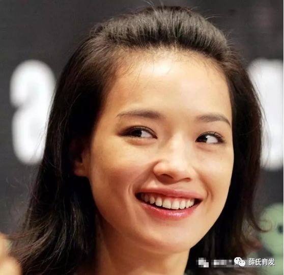 黑发小妙招去白发食疗,白发越来越多怎么治疗