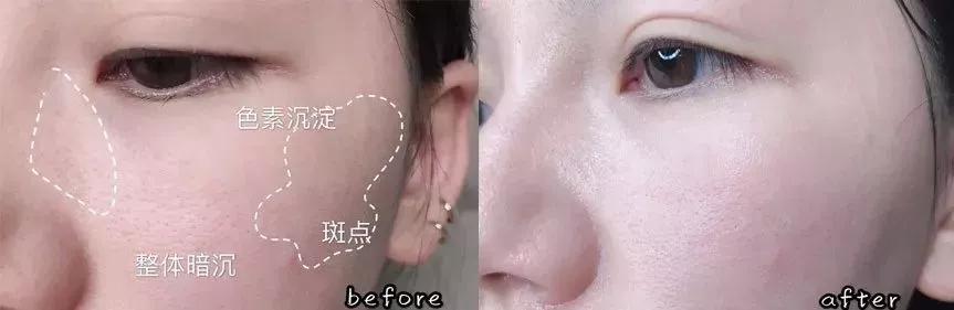 李小冉五官精致皮肤白皙透亮,70后女演员李小冉的高级搭配