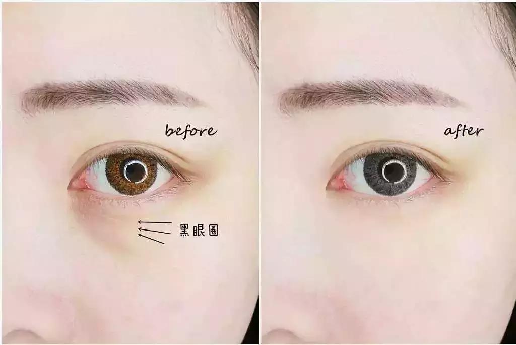 怎么挑选一款适合的眼霜,怎么选择一款适合自己的眼霜