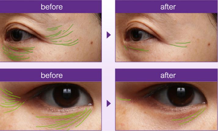 双11olay购买商品未到,olay双11下单攻略