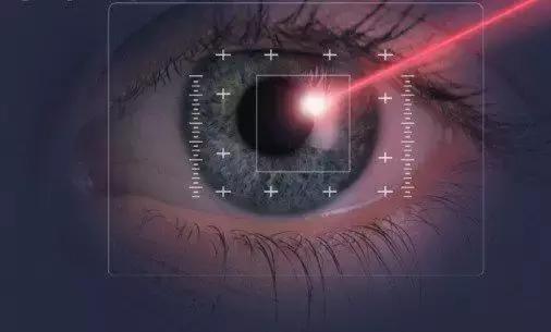 飞秒激光近视手术大概要多少钱,近视激光手术100%成功真的靠谱吗