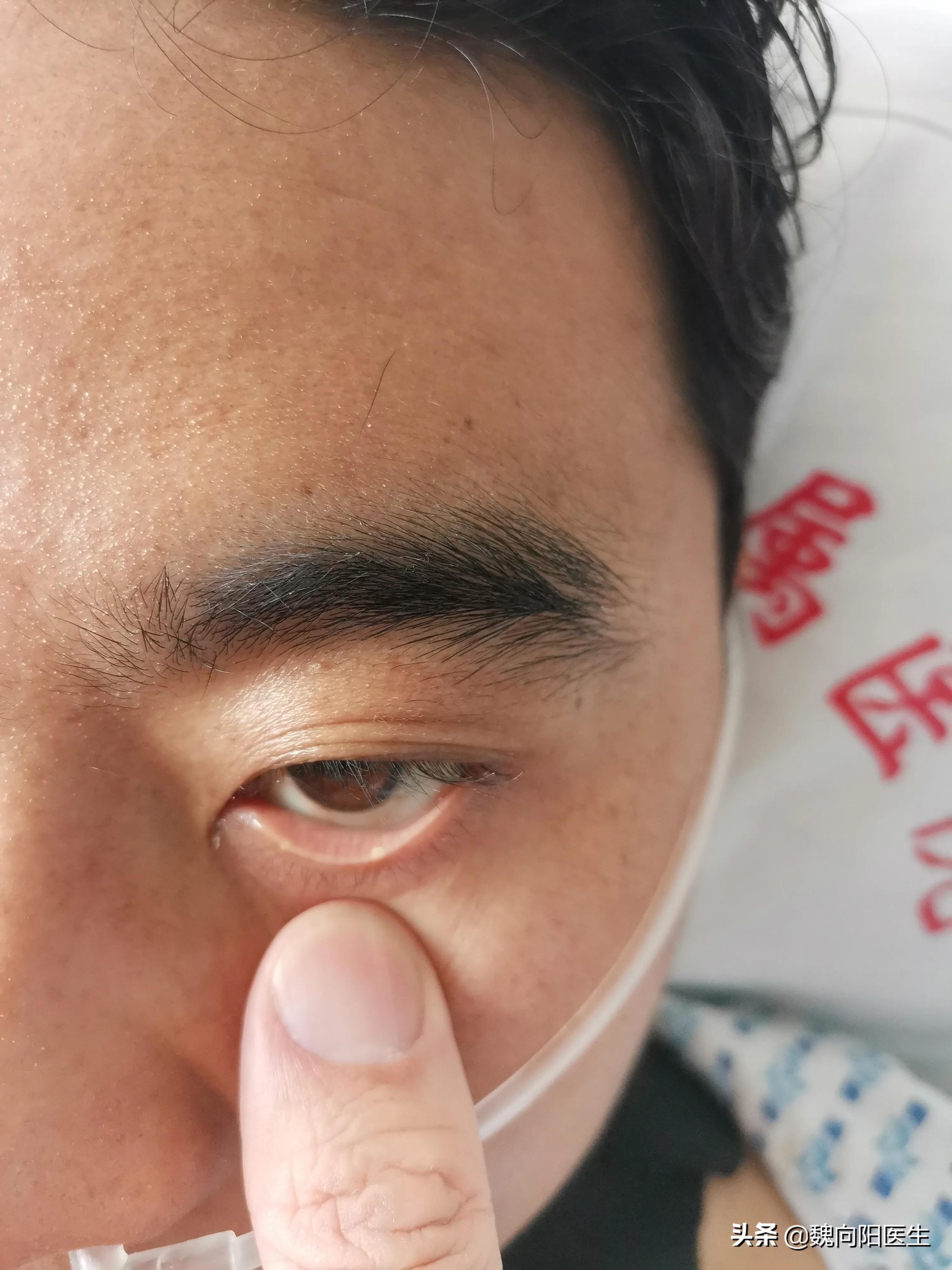 输了3000ml血,也没能留住他一条命,最终也没等到输血小板