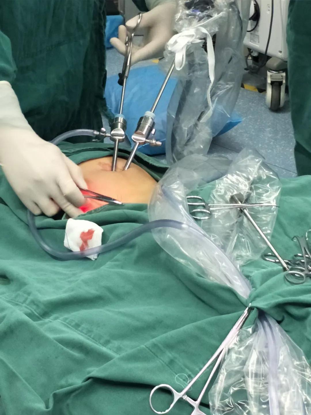 小孩呕血,小孩子突然吐血和便血什么原因