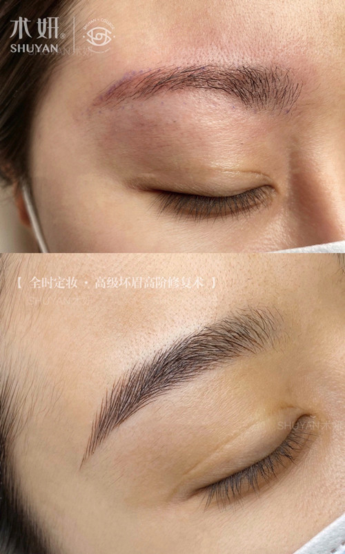 纹眉第二次补色还会结痂吗,不结痂纹眉一至七天过程图