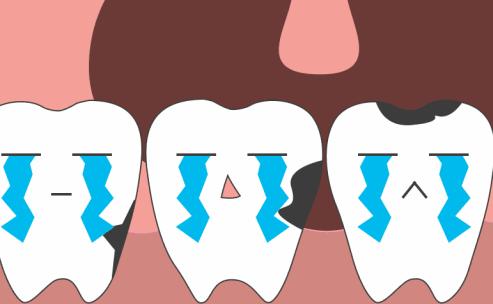 虫牙为什么会越变越大,为什么虫牙特别多