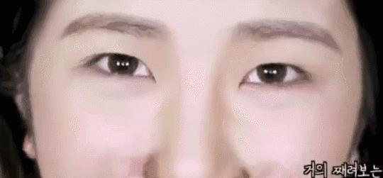 肿眼泡是什么原因啊,肿眼泡怎么贴双眼皮