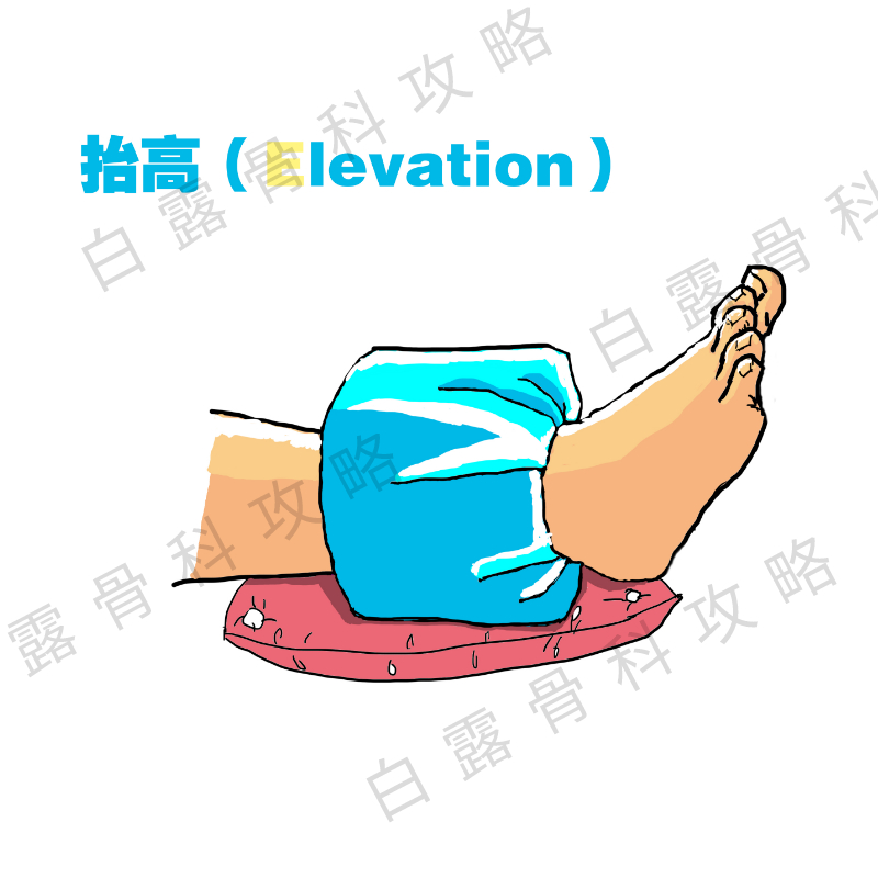 急性踝关节扭伤后的正确处理方法,踝关节扭伤要冰敷几次