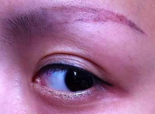 为什么很多人不适合纹眉,为什么不建议纹眉