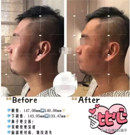 脸大真的不如脸小的好看吗,脸小真的显瘦吗