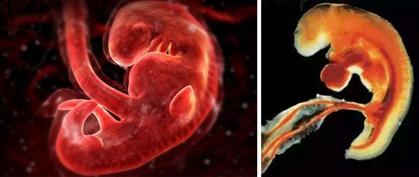 孕7周胚胎发育缓慢怎样才能更好,胎教0-6个月完整版