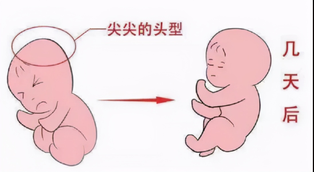 新生儿护理知识大全100题,育儿小知识新生儿护理常见知识