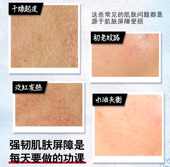 秋天皮肤特别干用什么面霜,秋季皮肤干燥用它保湿没烦恼