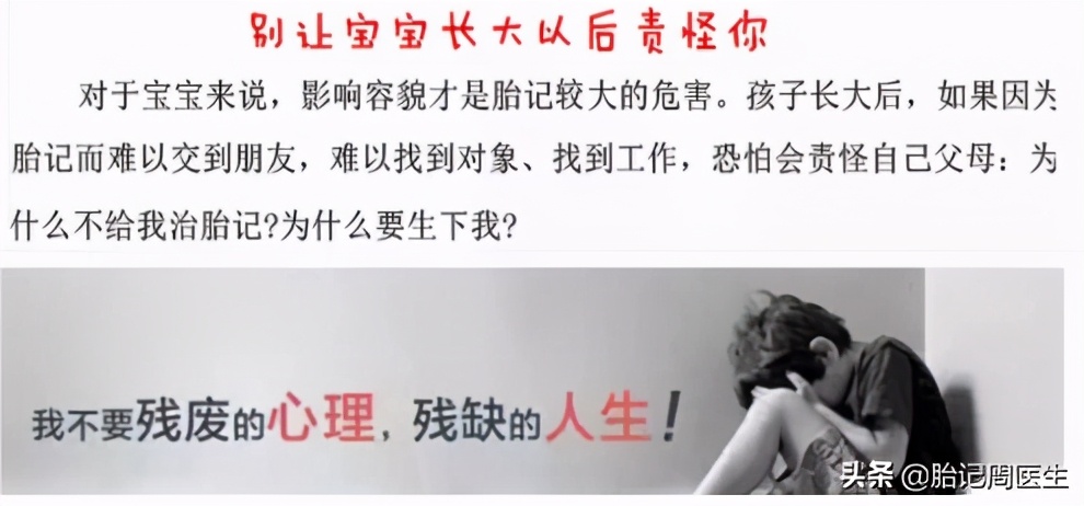 经常喝咖啡真的会导致脸上长斑吗,小孩脸上有咖啡斑怎么办