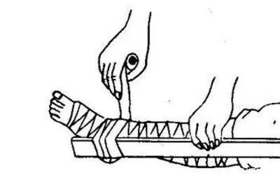 运动中踝关节扭伤的动画科普视频,踝关节扭伤症状评估