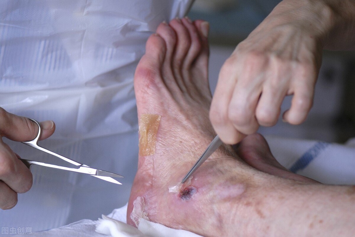 碘伏消毒液在衣服上的妙用,碘伏的妙用小妙招