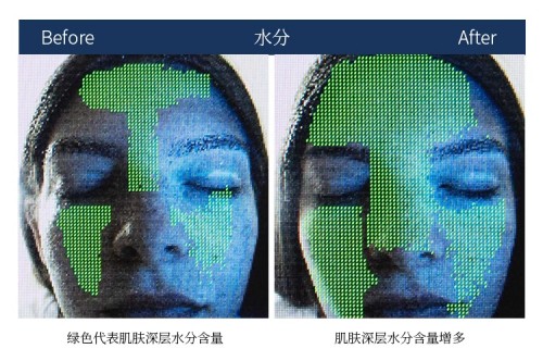 澳洲cemoy面霜真的好用吗,cemoy面霜修红测评