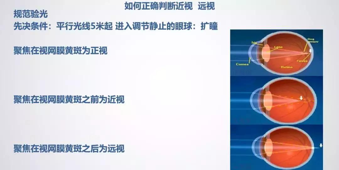 五官科医院周行涛近视手术,周行涛近视眼手术靠谱吗