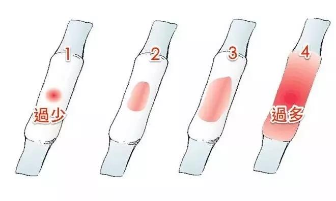 月经量越来越少,两三天就没了,有可能不孕吗?