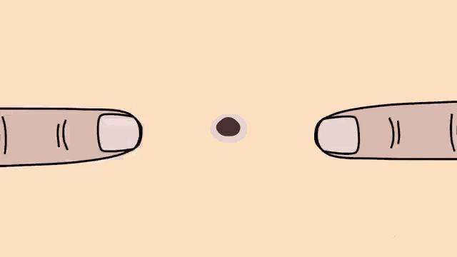 为什么痘痘好了后毛孔会变大,毛孔粗大痘印痘坑是怎么引起