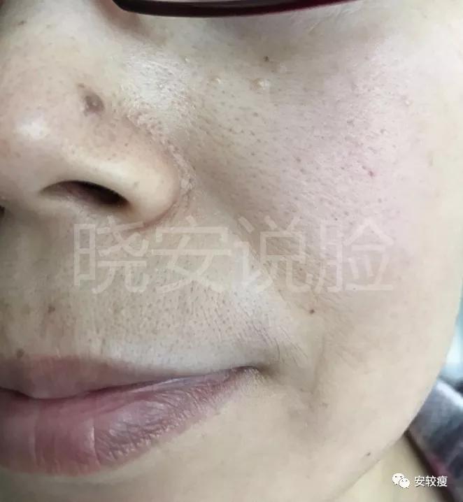 熟龄肌抗皱护肤品,35岁以上好用的抗老抗皱紧致测评