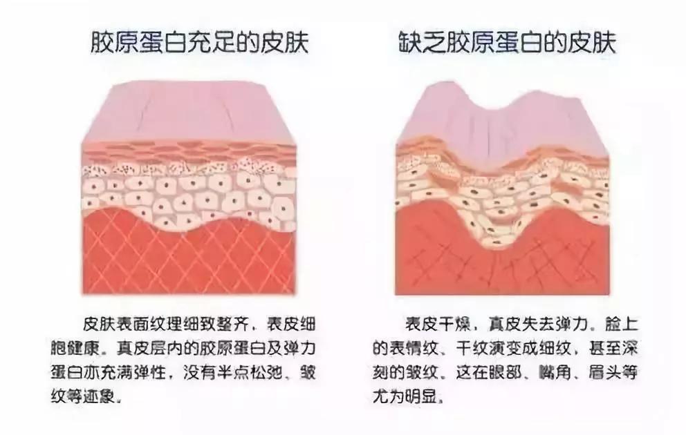 改善皱纹松弛抗皱乳液,抗皱松弛淡化皱纹鱼尾纹