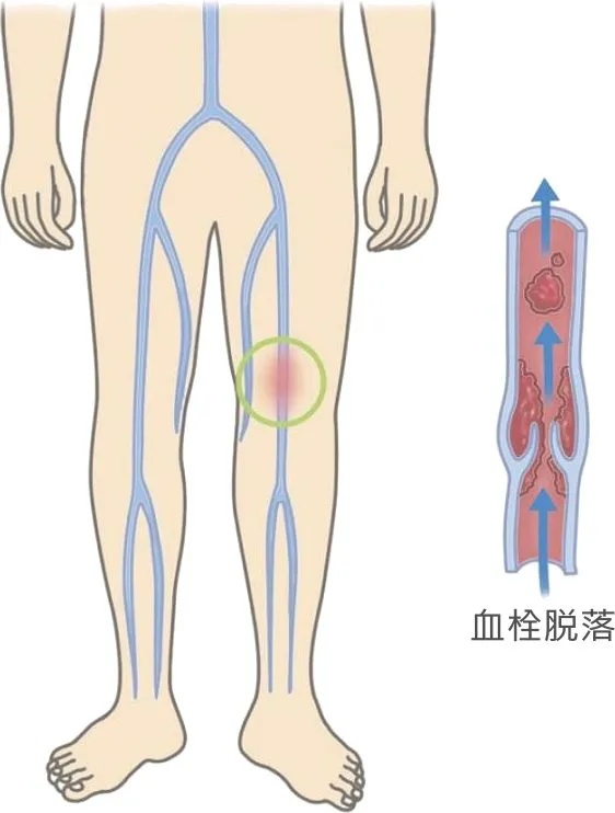 西安红会医院心血管住院部,西安市红会医院心血管内科地址