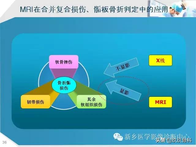 骨骺损伤x线表现,骨骺损伤磁共振表现