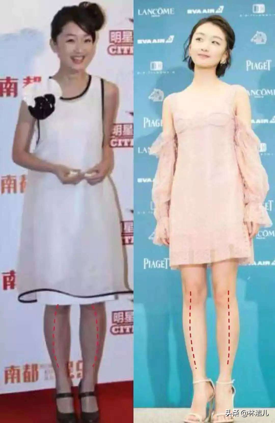 大腿粗小腿粗怎么通过运动改善,大腿粗小腿细怎么办