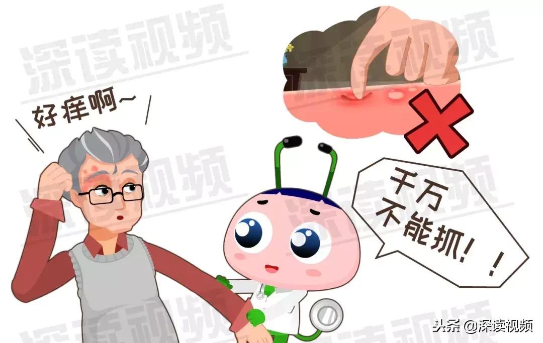 水痘和带状疱疹的关系你了解多少,水痘病毒引起的疱疹