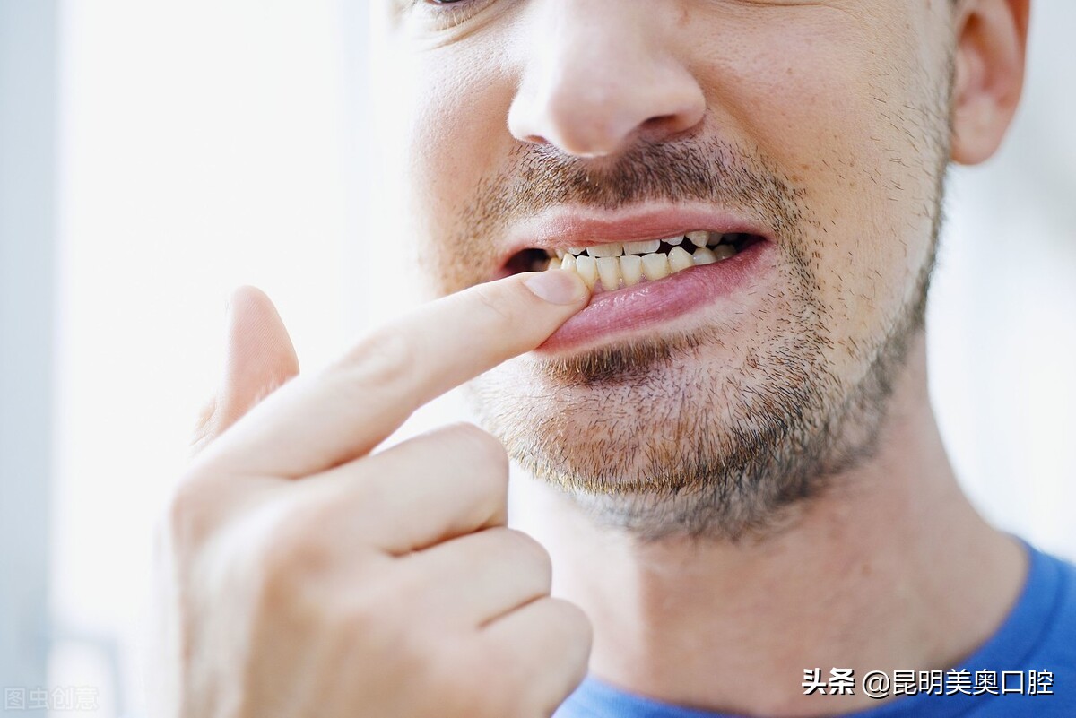 牙齿美白误区有哪些,美白牙齿的误区都有哪些