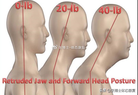 矫正体态消除富贵包,立竿见影消除富贵包绝技