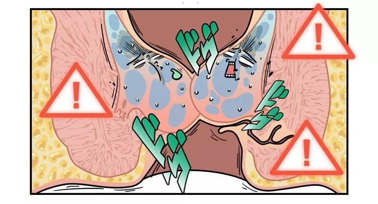 有痔青年如何远离痔疮,有痔青年怎么治