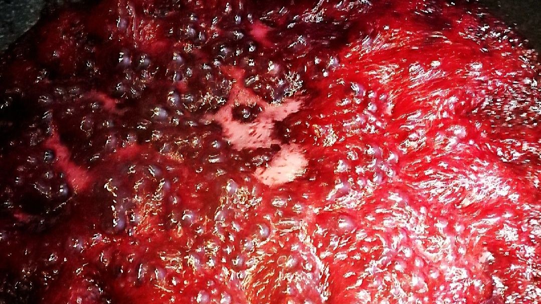 杨梅的清洗正确方法,杨梅正确清洗方法