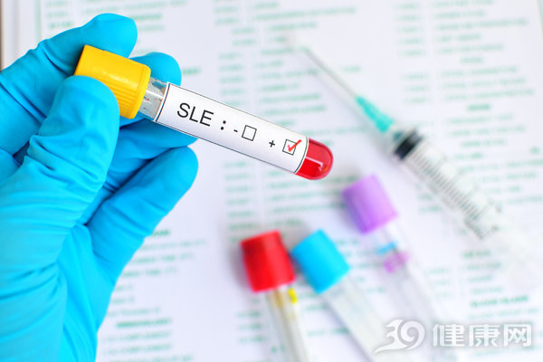 专家揭秘红斑狼疮的真面目,红斑狼疮是皮肤病么