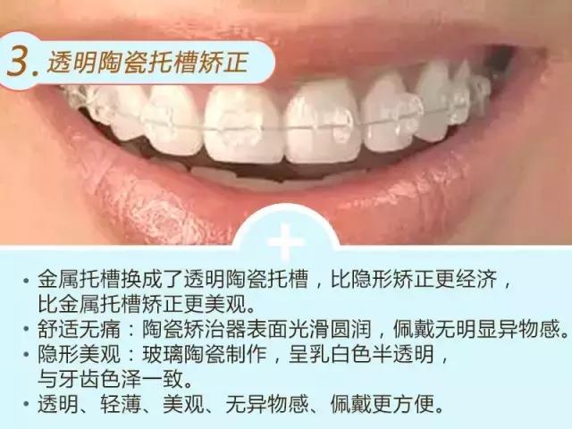 牙齿深覆合龅牙矫正过程,龅牙地包天怎么弄