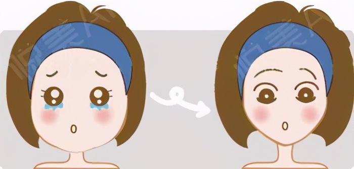 面部吸脂适合哪种吸脂方式,面部吸脂用什么吸脂方式