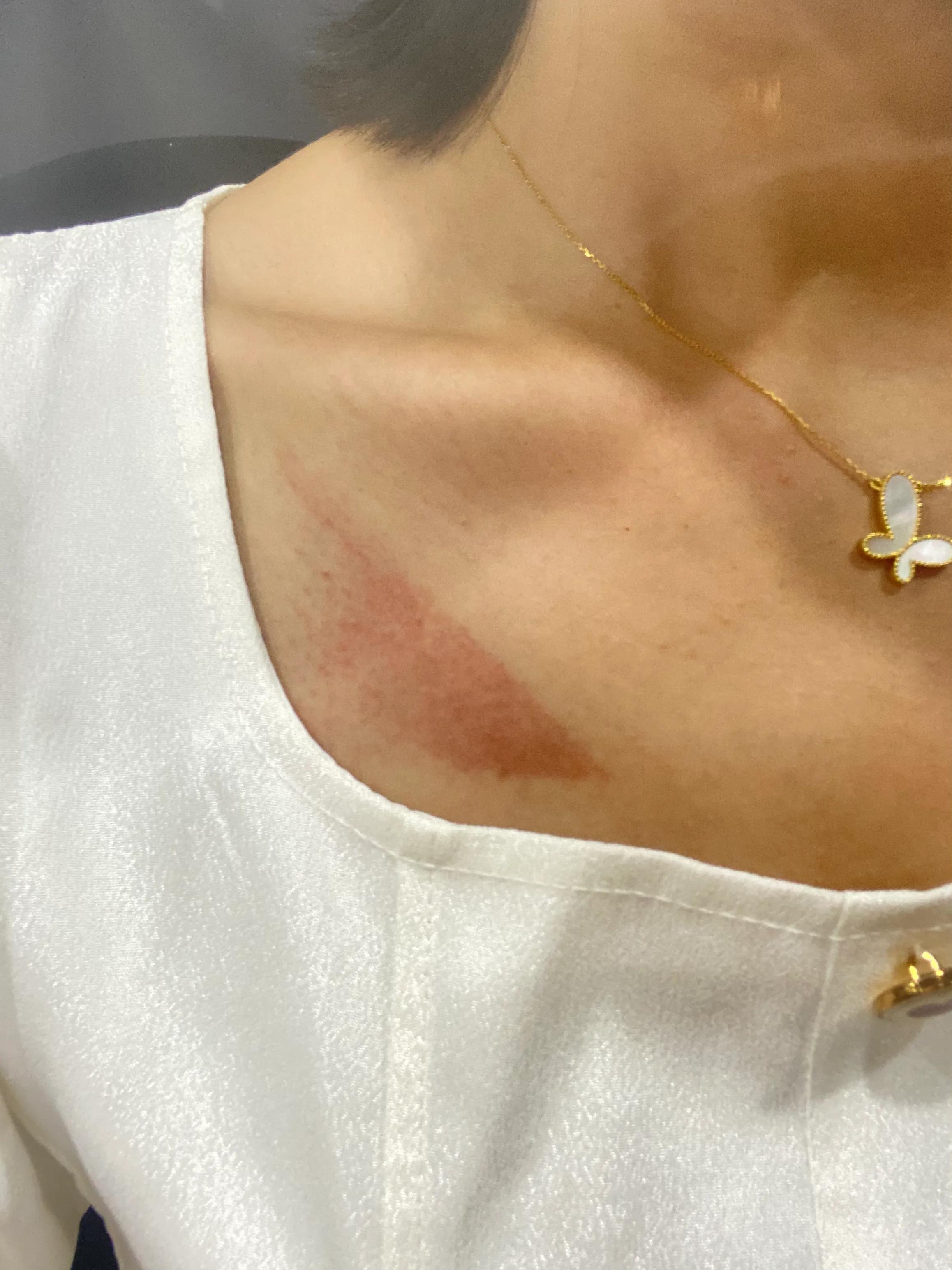 领克03低速行驶车辆无损伤无刮擦无碰撞弹出安全气囊并爆炸