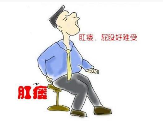 痔疮和肛瘘哪个严重一点,痔疮和肛瘘有区别吗哪个严重