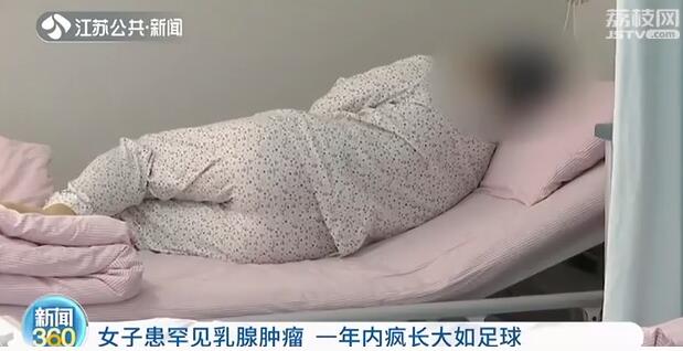 女子患罕见肿瘤,女性乳腺肿瘤
