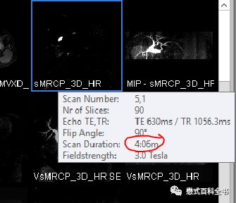开展mrcp技术,mrcp检查操作流程