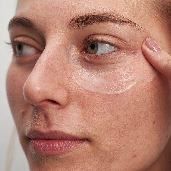 眼周水肿的原因分析,如何改善眼皮浮肿