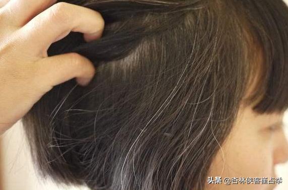 乌发固发补肝补肾的中药泡水喝,补肝脾能改善白发吗