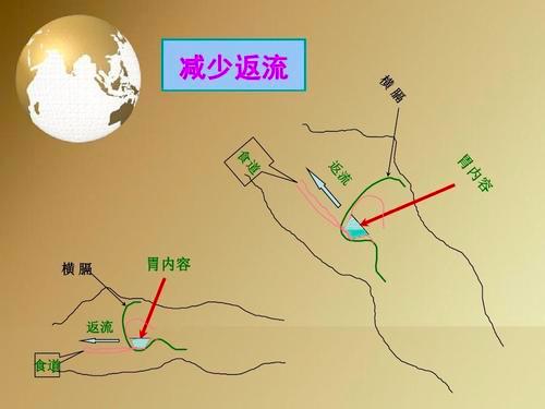 留置胃管的护理记录怎么写,出院后胃管护理宣教