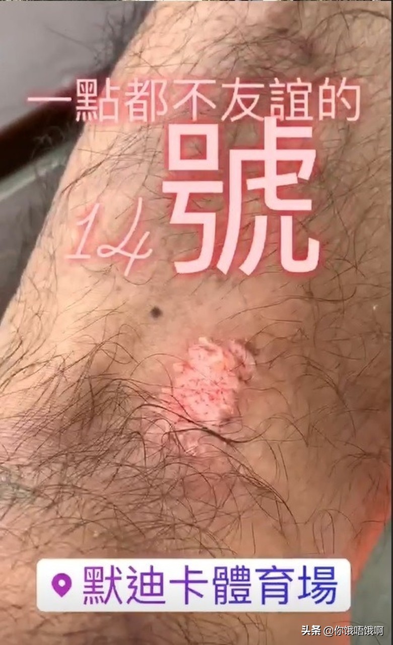 李克勤在足球场受伤连续发文炮轰对手网友：现场粗口教学