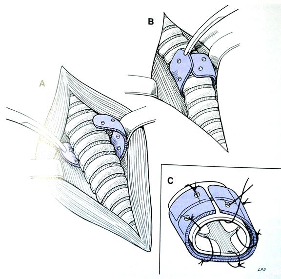 狗气管塌陷做什么检查,什么是犬气管塌陷