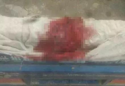 8岁女孩医疗事故身亡,8岁女童摔伤后续